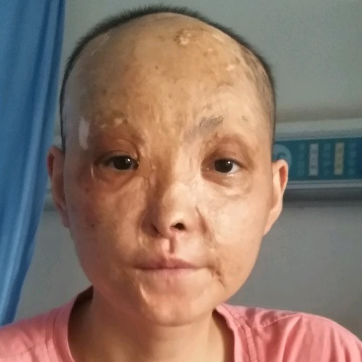 抗癌小余