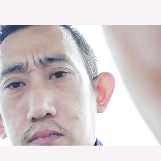 小强艾尚灸