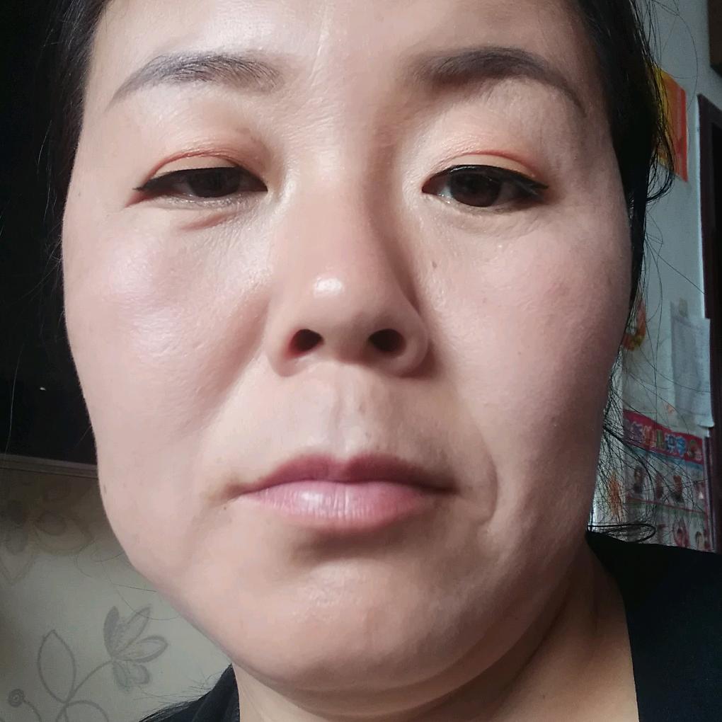 张娜
