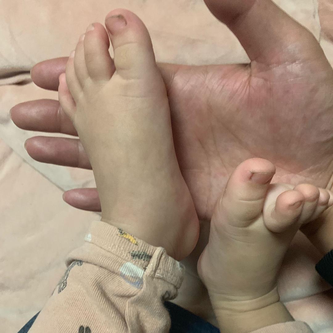 阿包