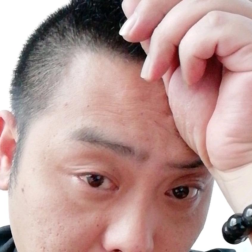 反应迟钝