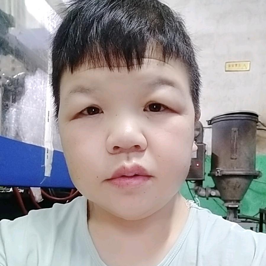 小矮哥