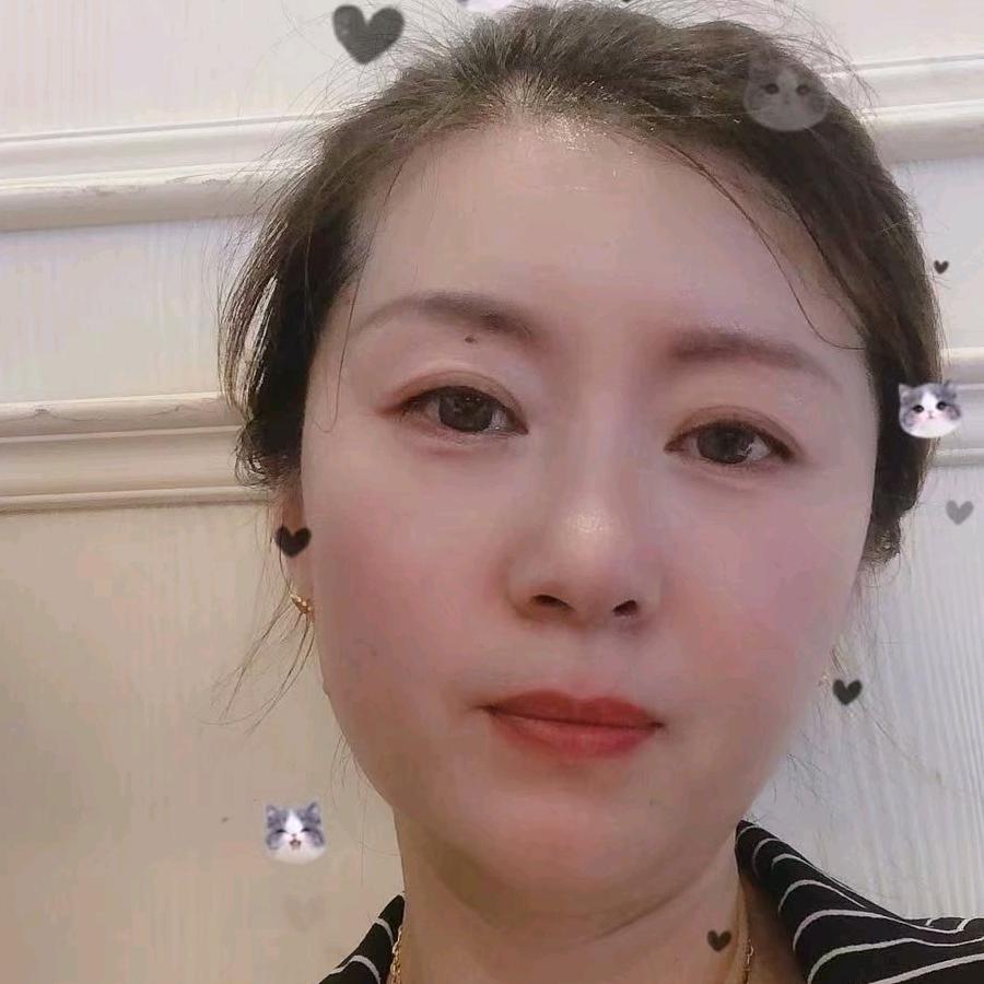 戚敏