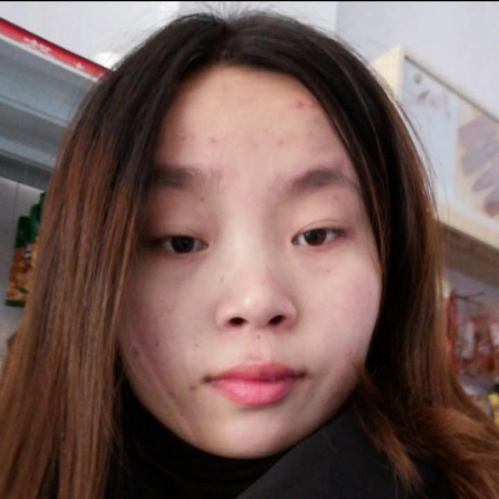 哲哲