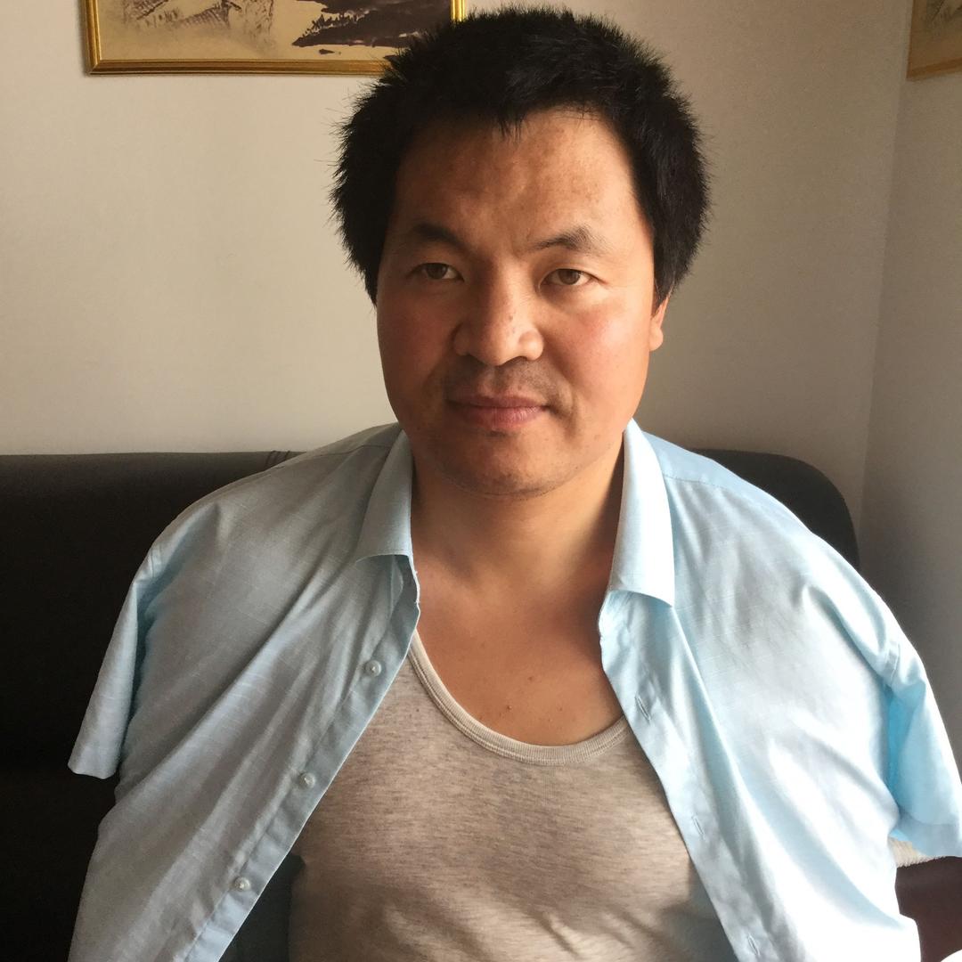 中医灸疗师