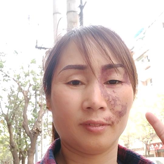 🌸红梅