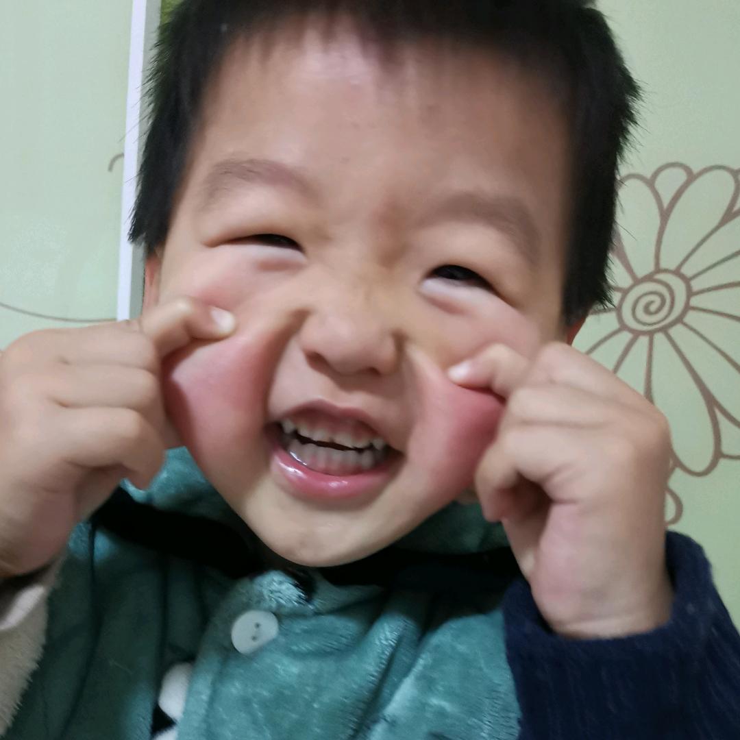 球球