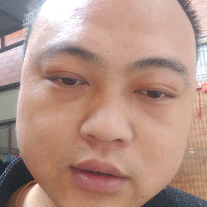 有点憨