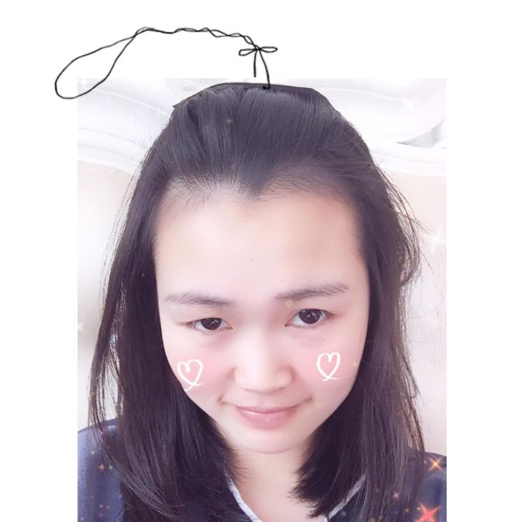 佳丽-LYX💕