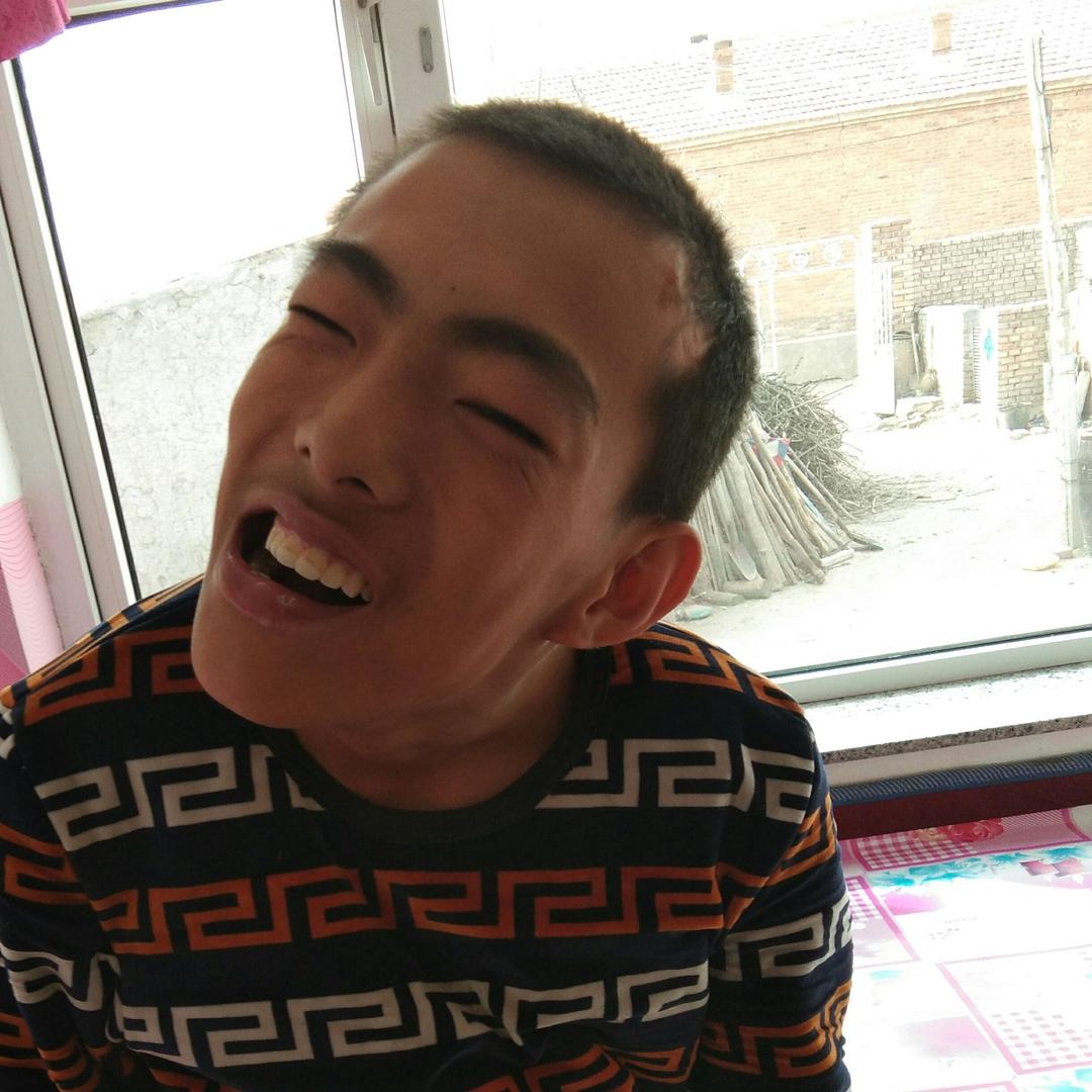 脑瘫孩子赵