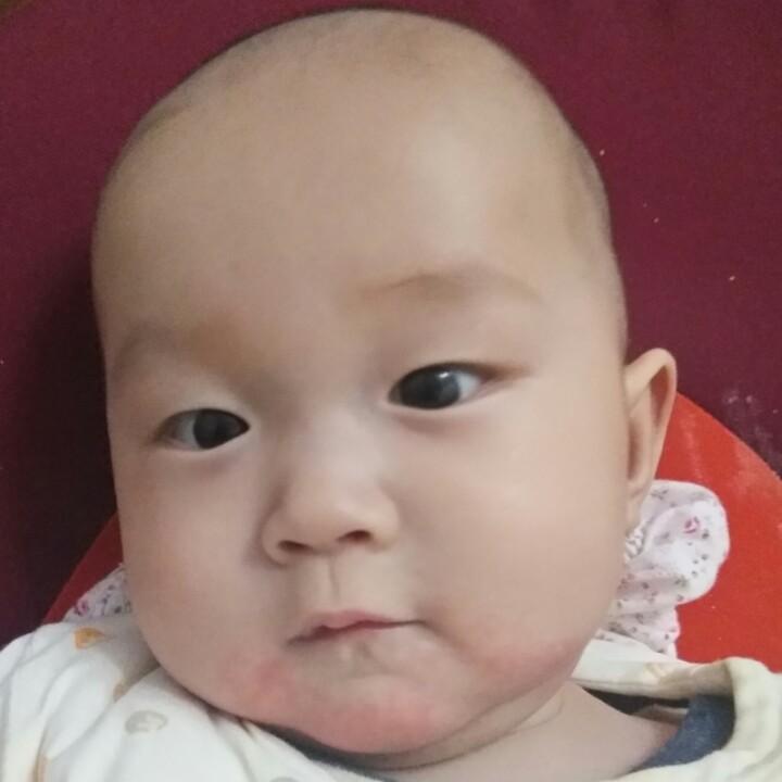 米