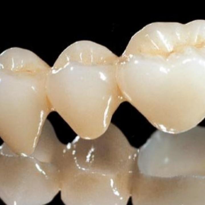 912795728