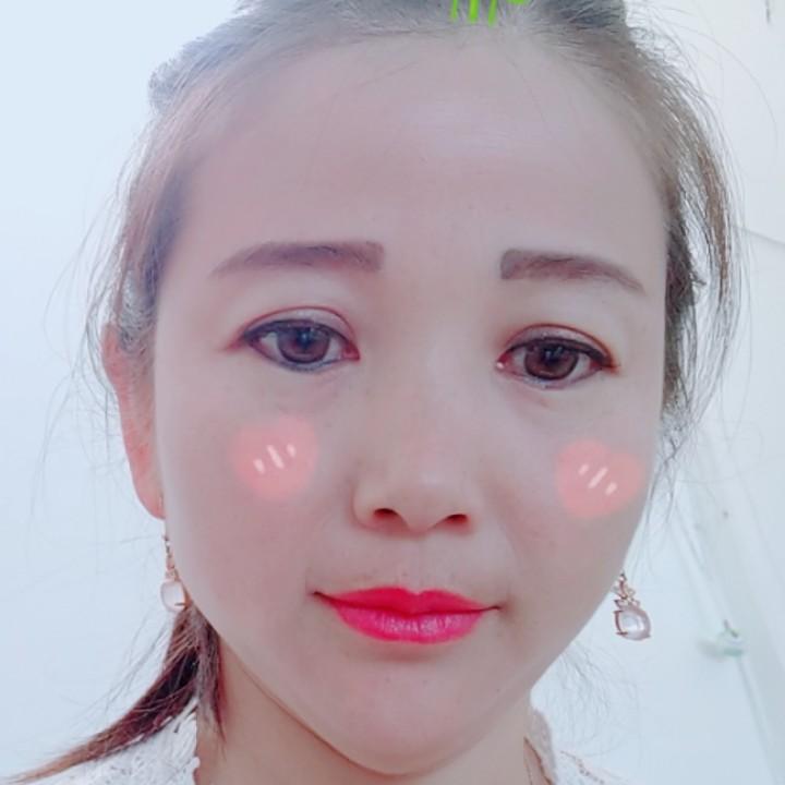 王丽