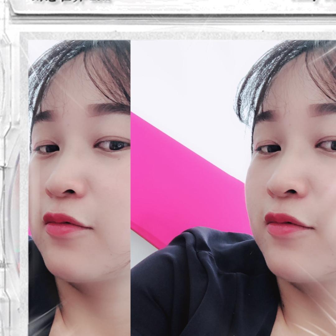 云云