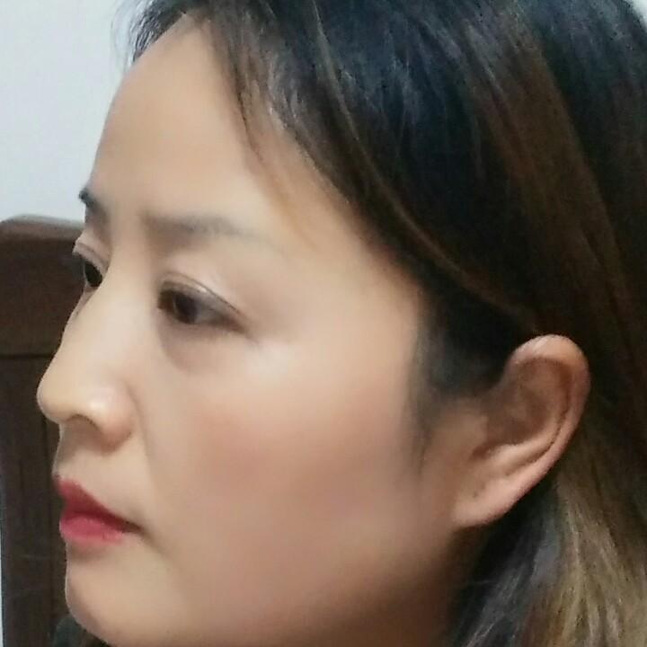 利