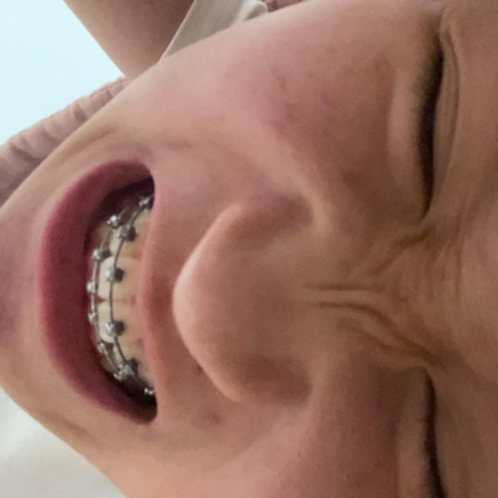 反义词