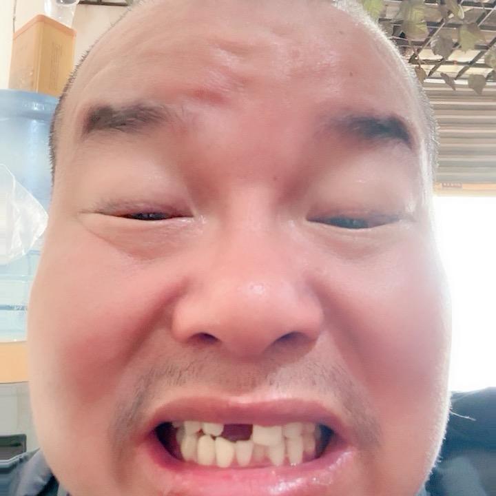 缺牙锅小号