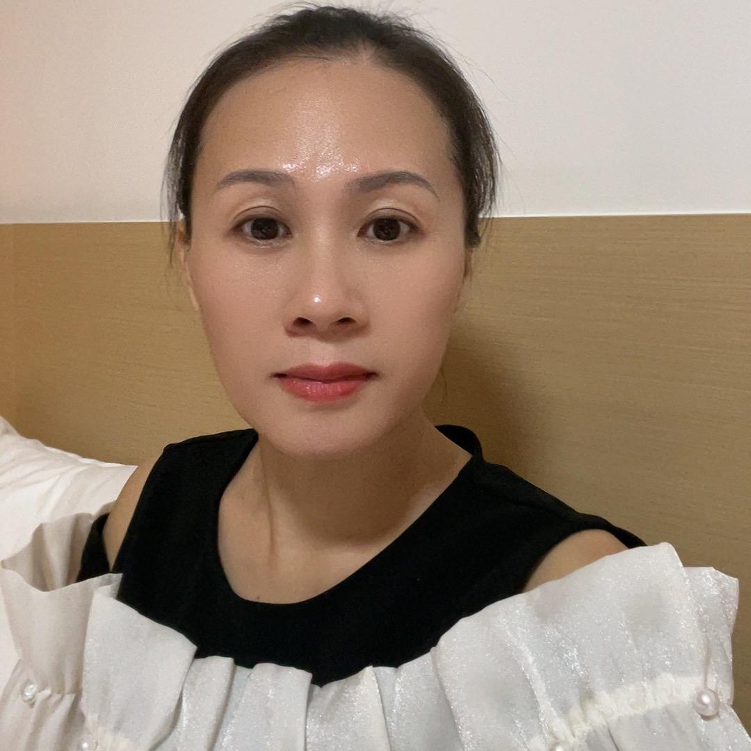 Ting（拒绝连赞）