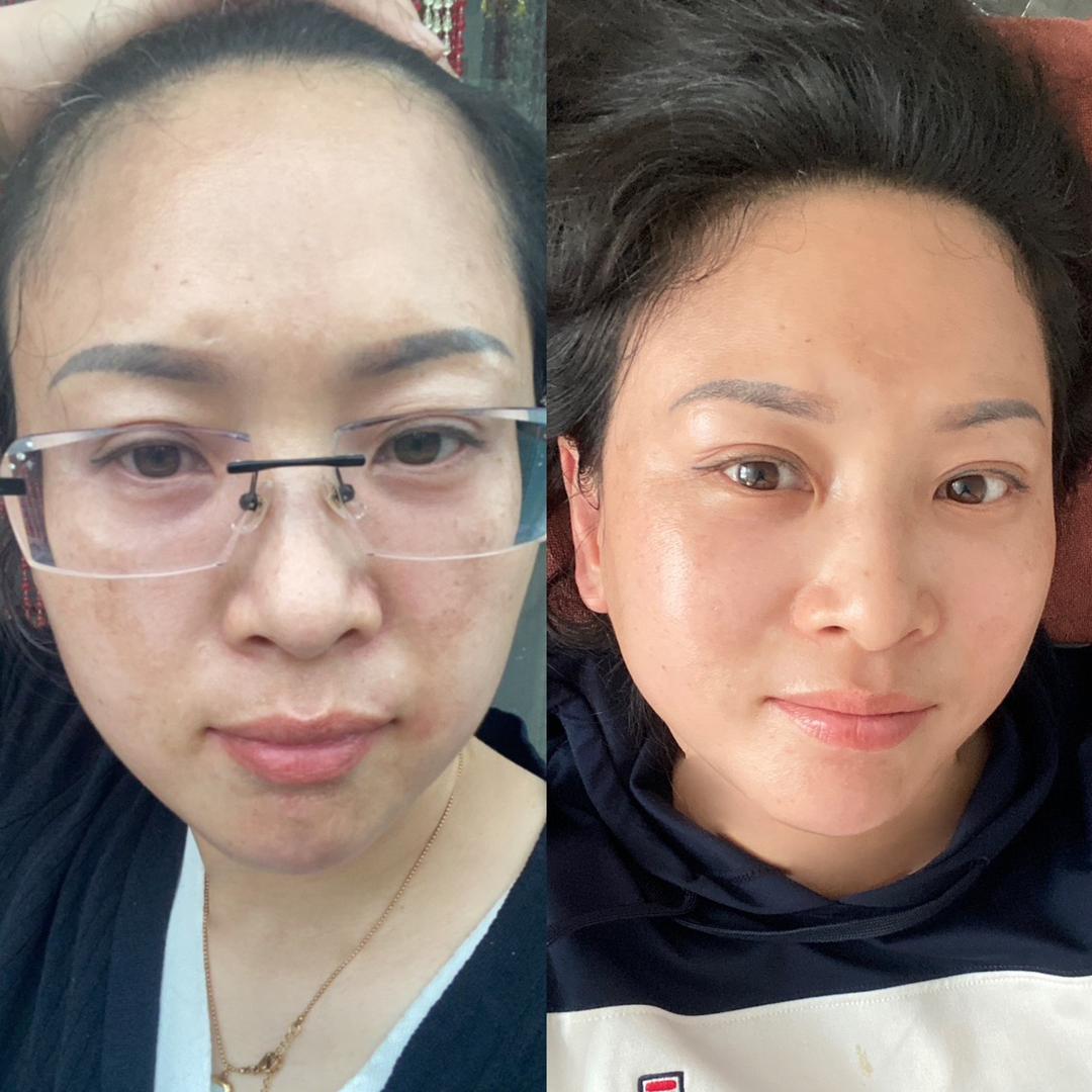 吕老师皮肤管理十五年老店官方号