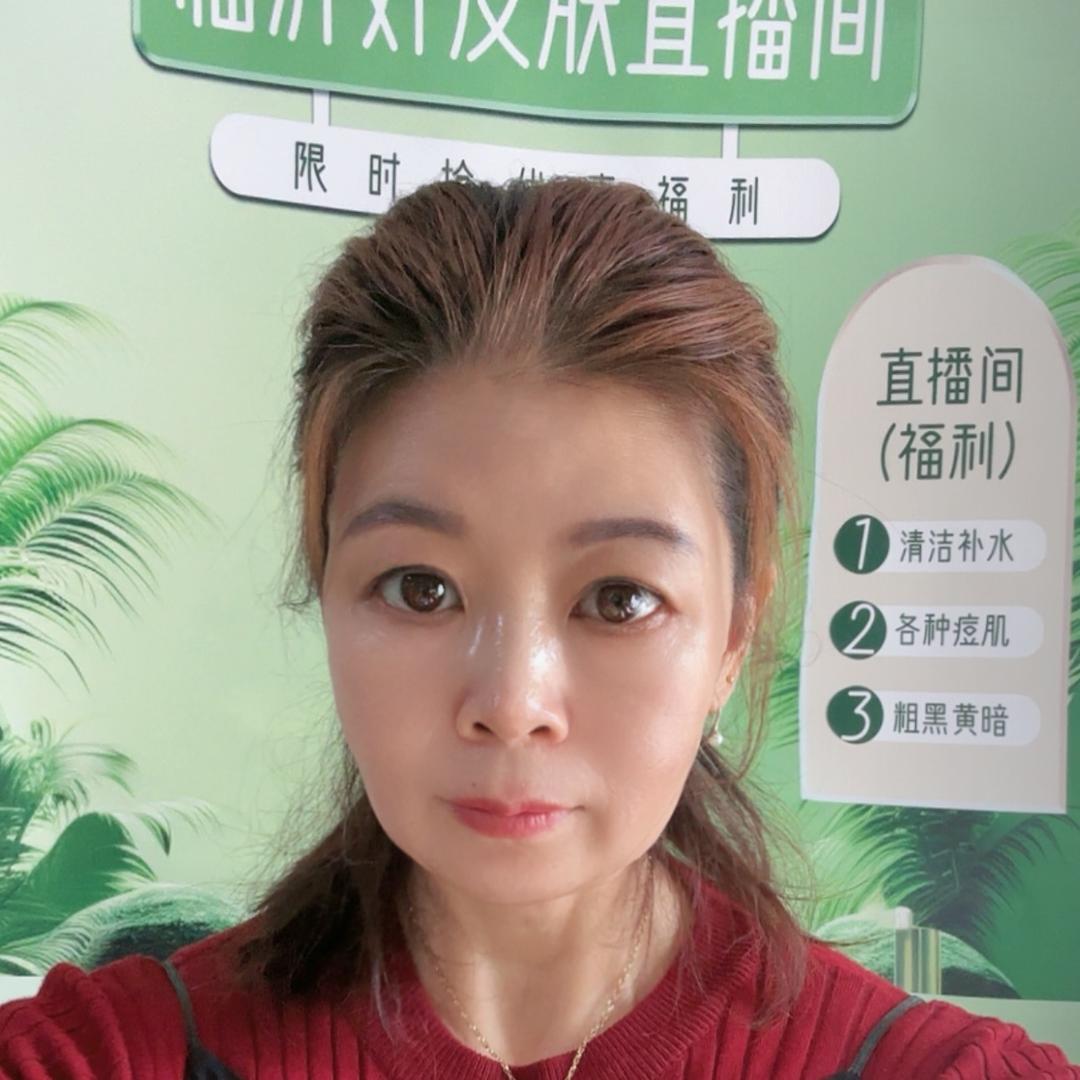 临沂赵蕾问题肌