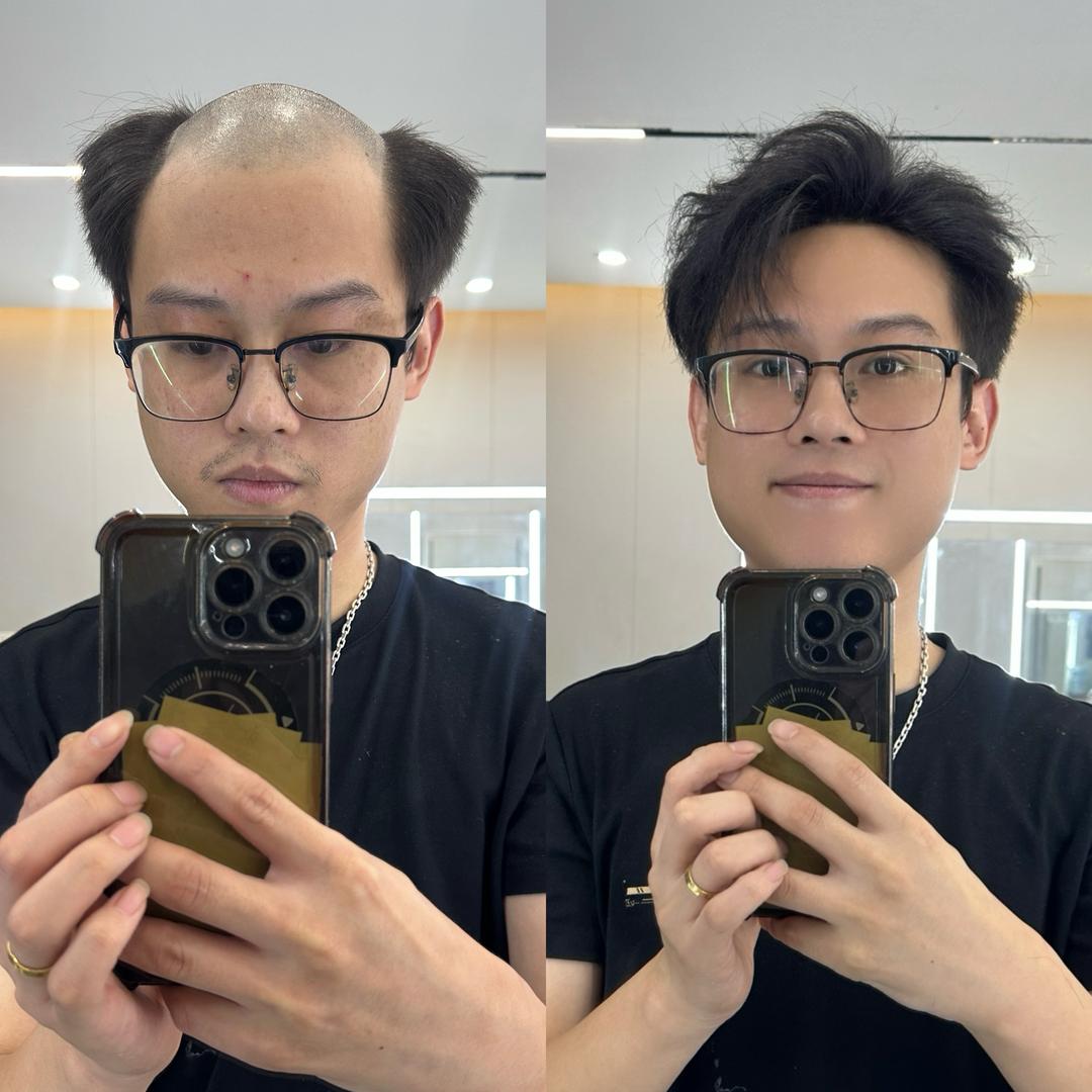 宁波假发阿勇 oimg