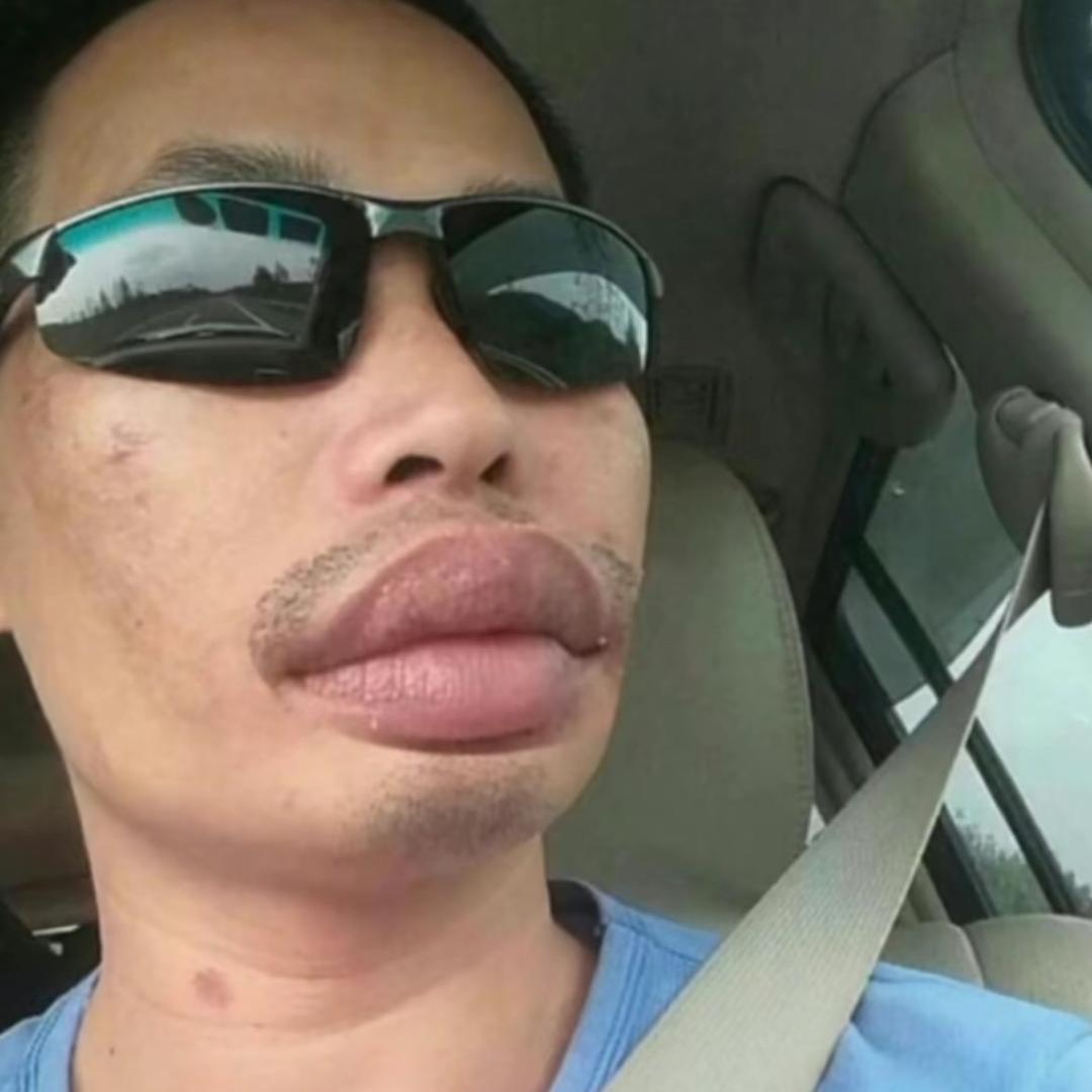 -