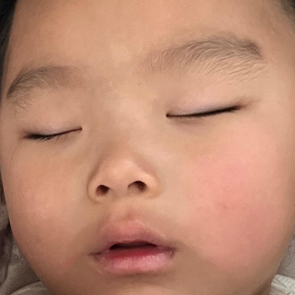 张小布