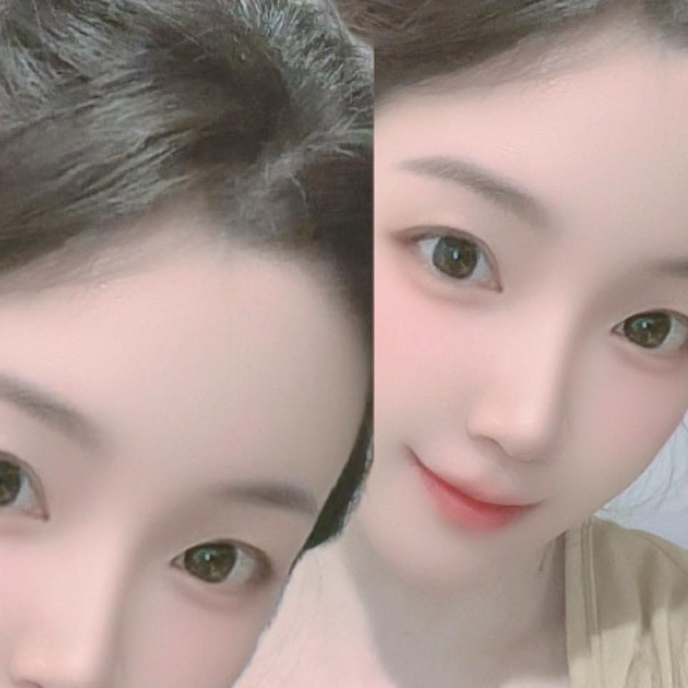 青青
