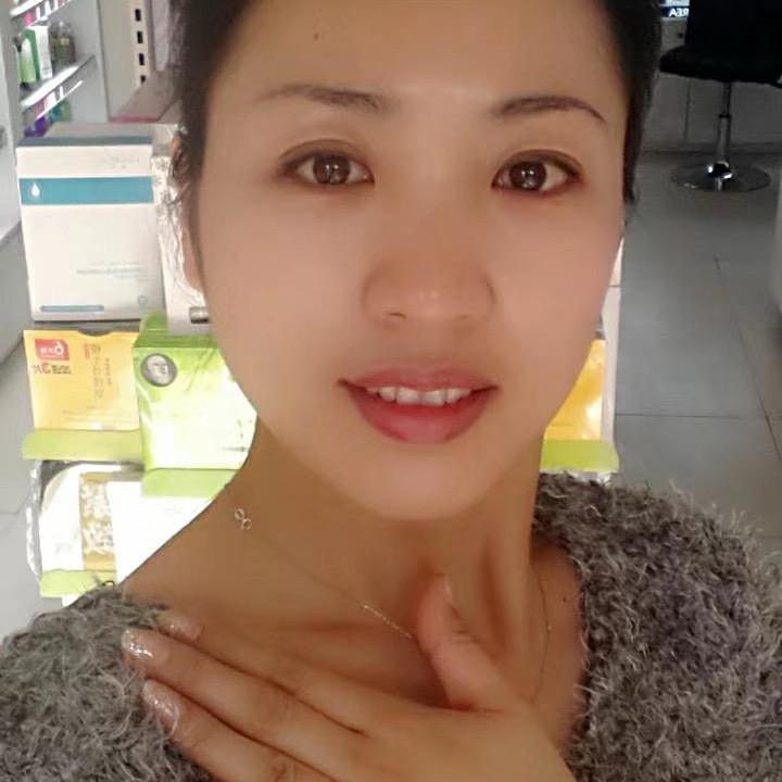 红姐（已生刨腹产）