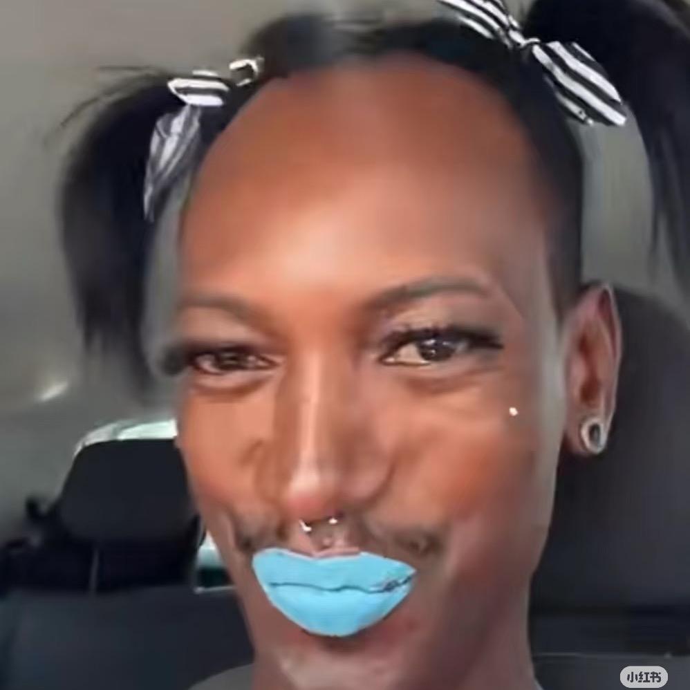 阳光（增肌中）