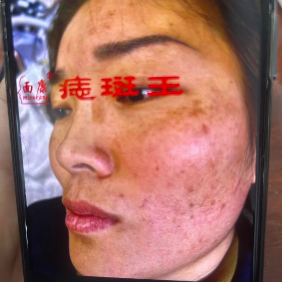 新沂（静姐）3️⃣决斑女王(海霞婆婆)