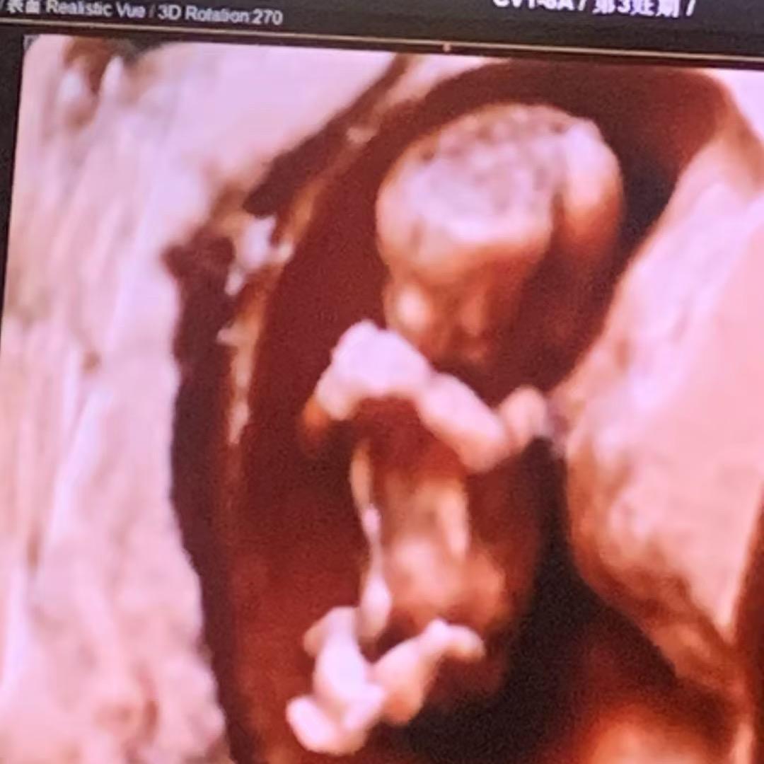 希雅宝贝👶