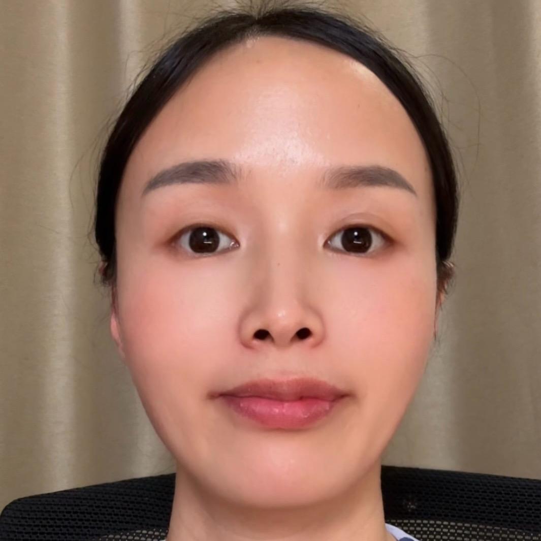 孙爱喜（脸部肌肉锻炼）