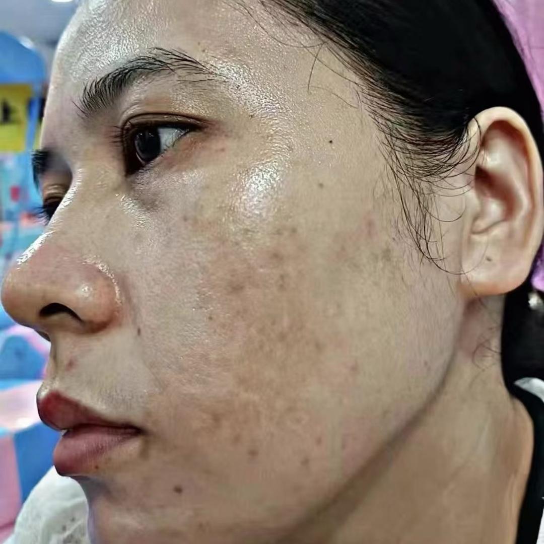 苏丽燕