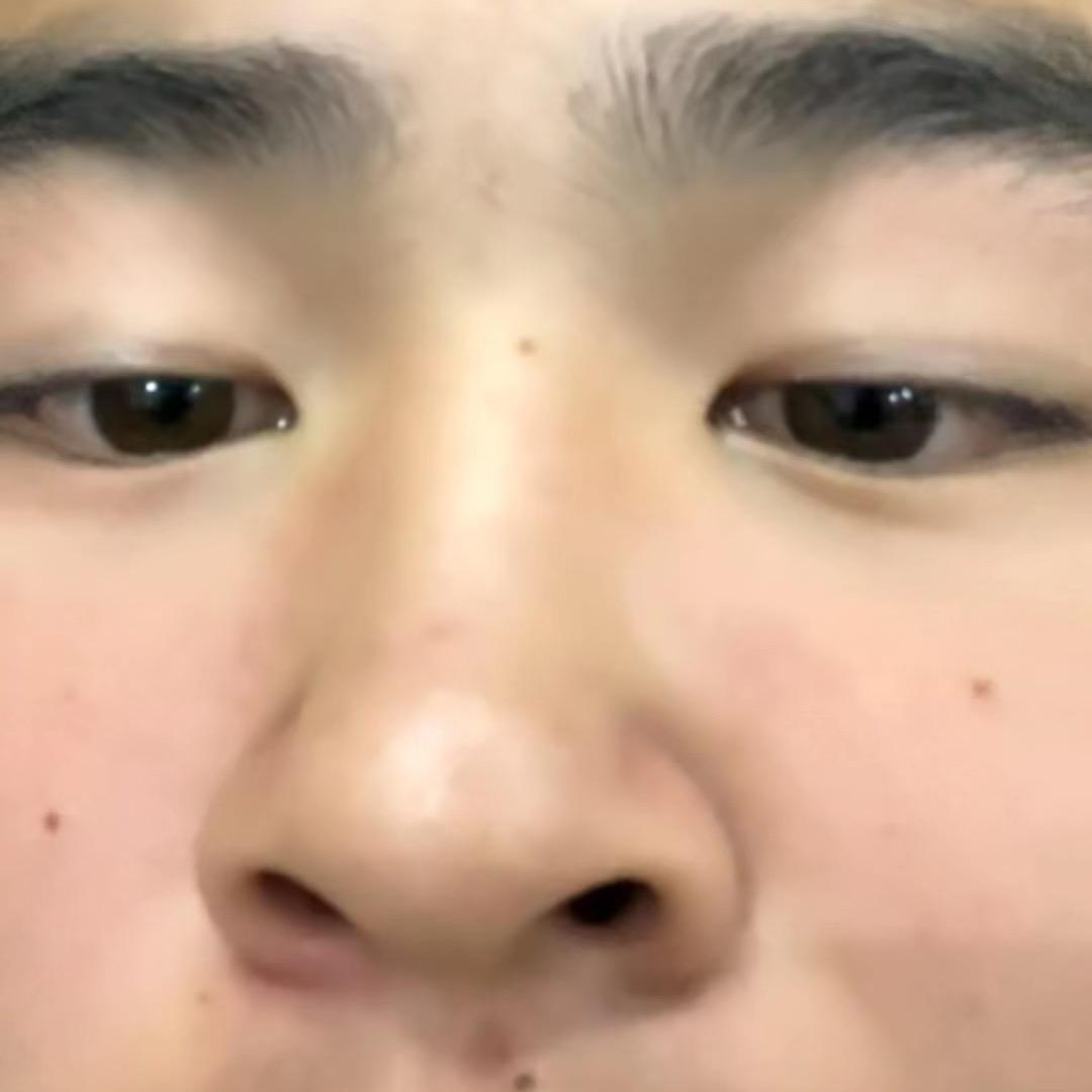 -0723.