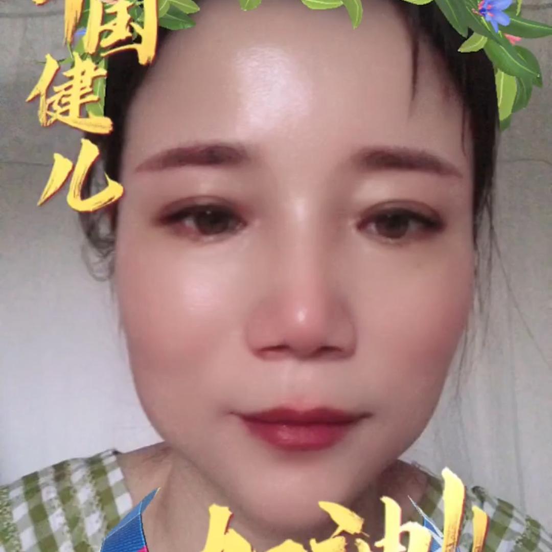 芳
