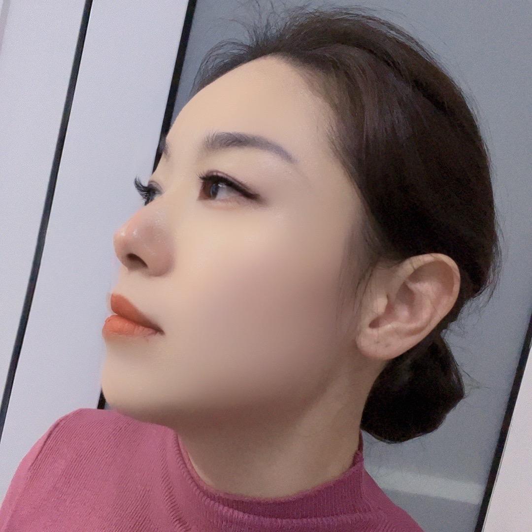 开心😃