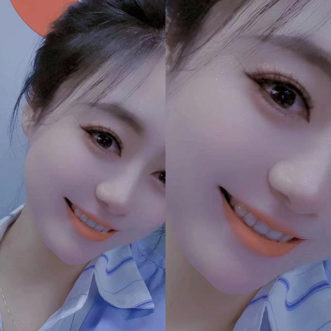 小棉妃