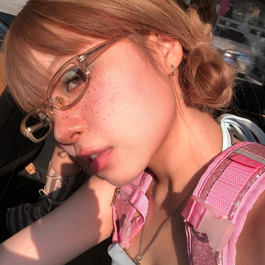 雀斑儿