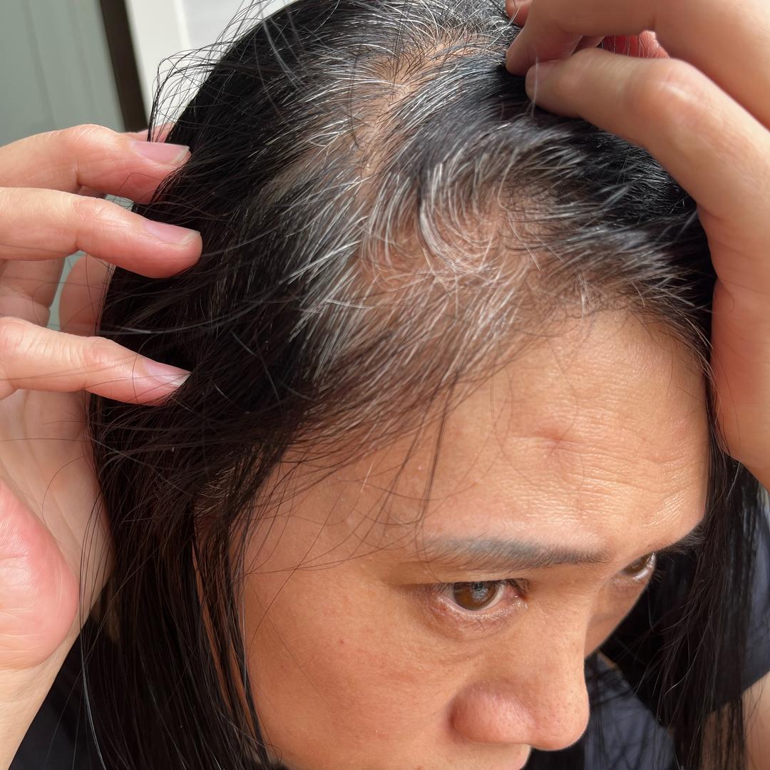 白发养黑-熊老师