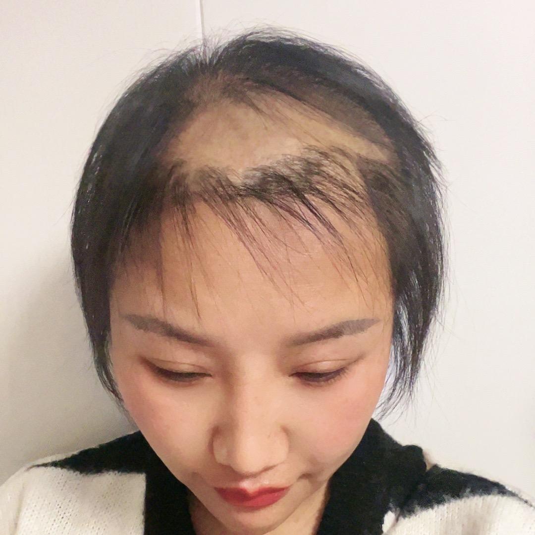 夏鑫养发