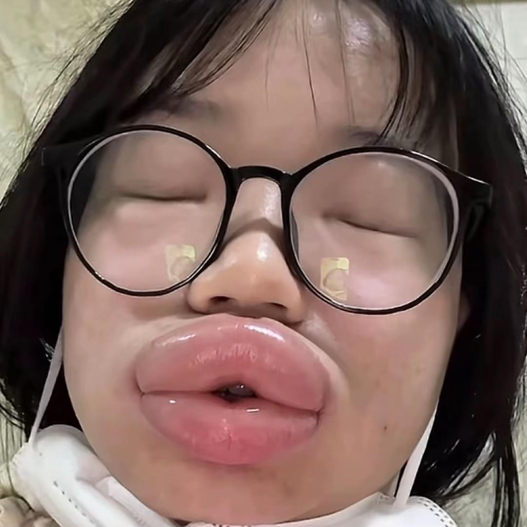 不吃西兰花