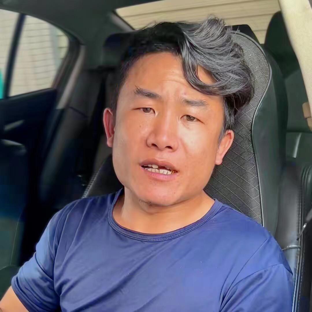 缺牙