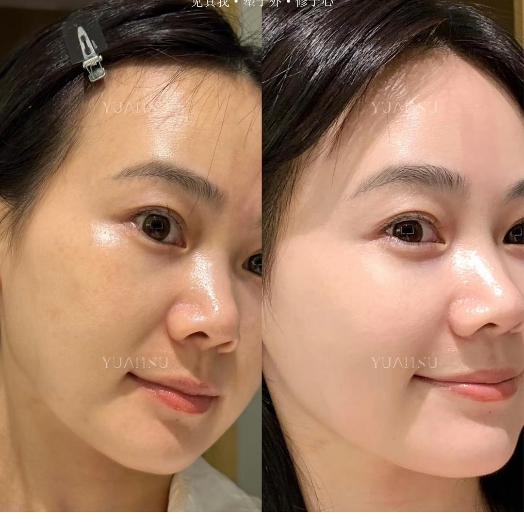 金秋创影 刘奕彤