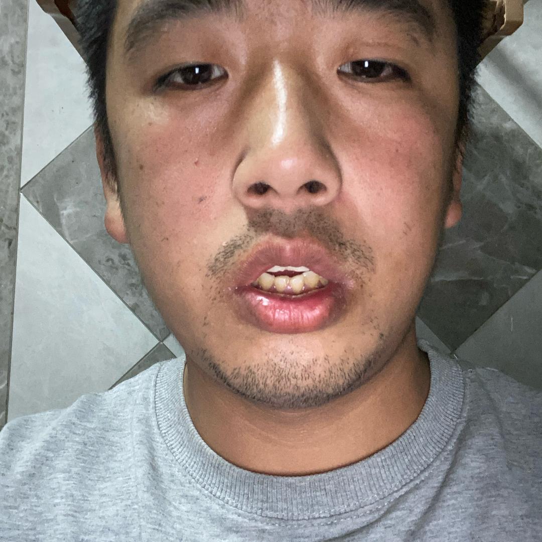 开心果沈佳焌