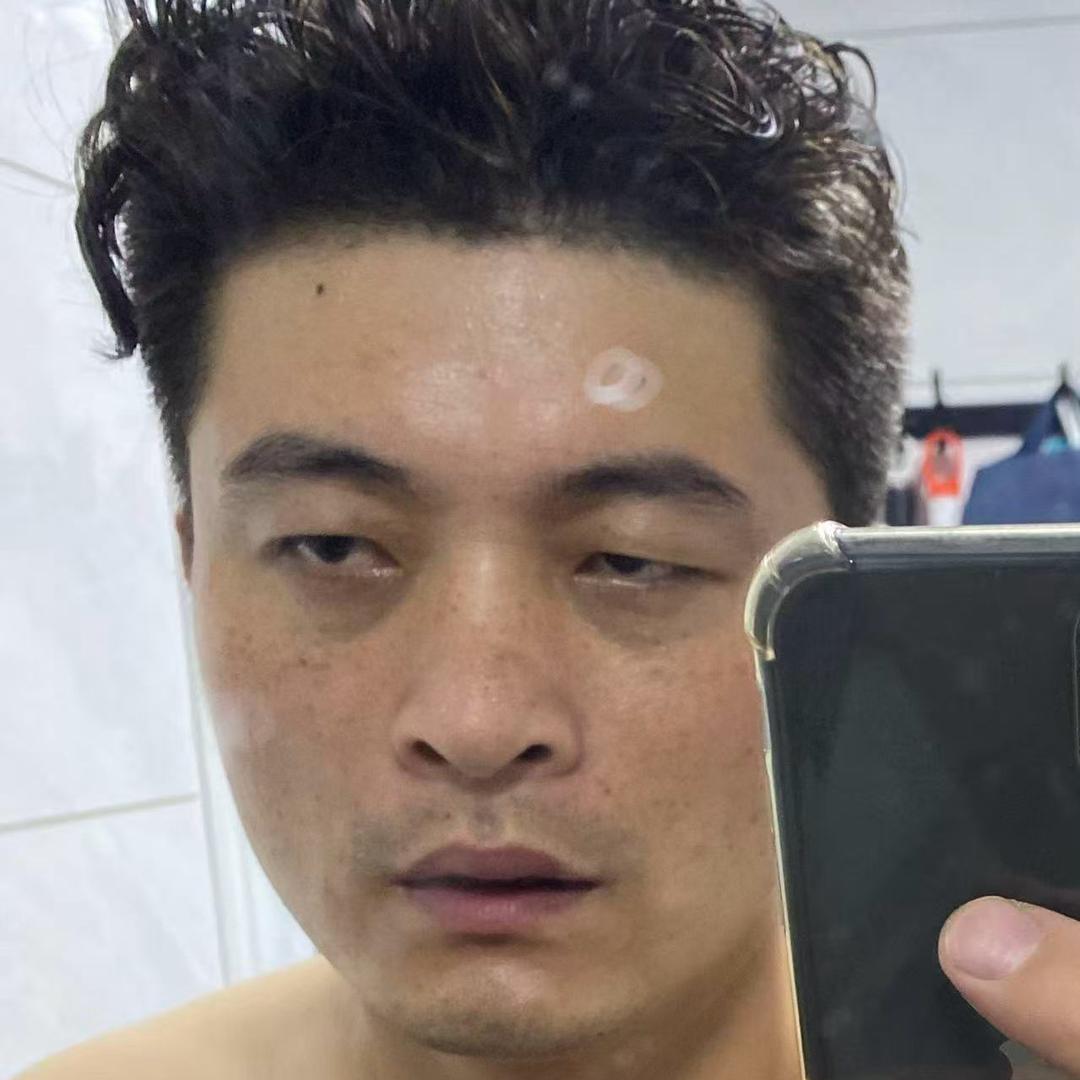 哇哇哥.改变面相