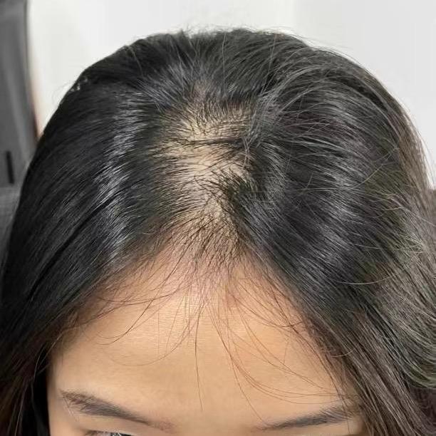 西安-丝纯one物理增发