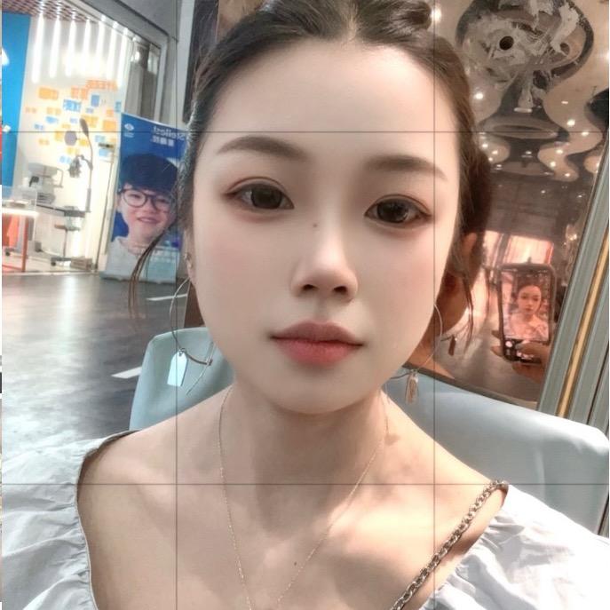 小雅1