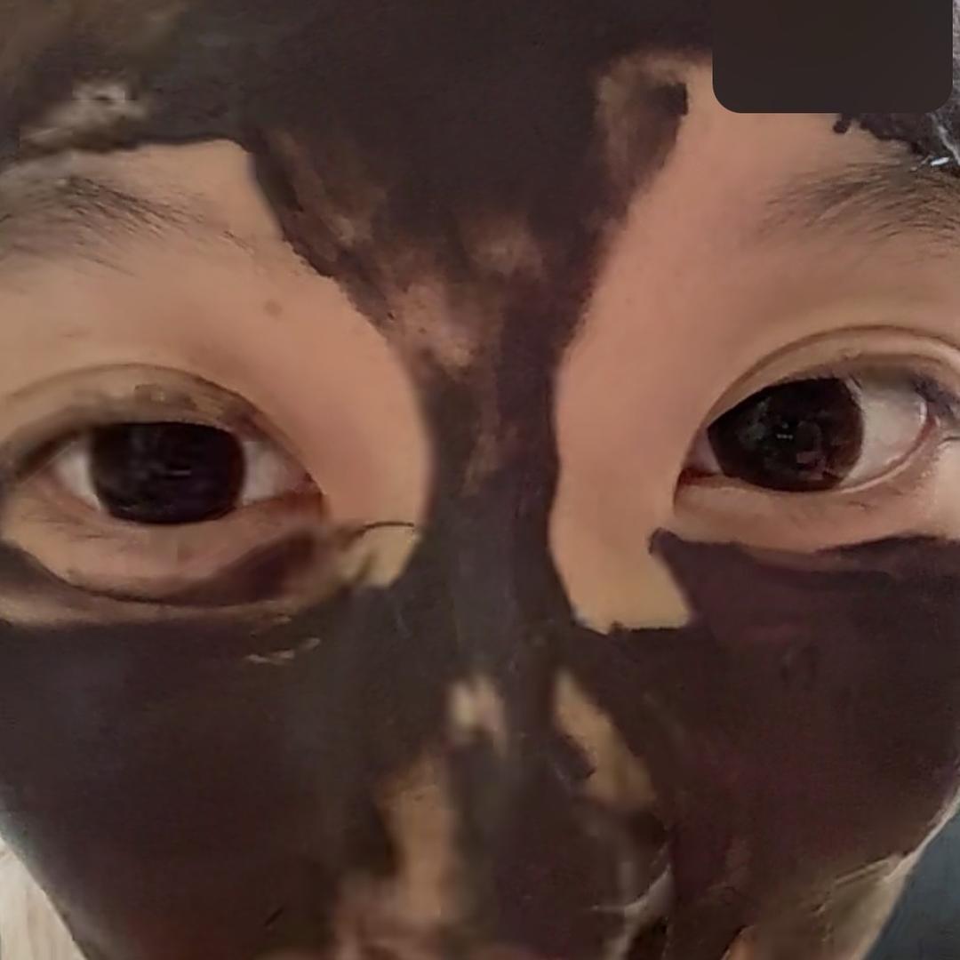 左眼皮