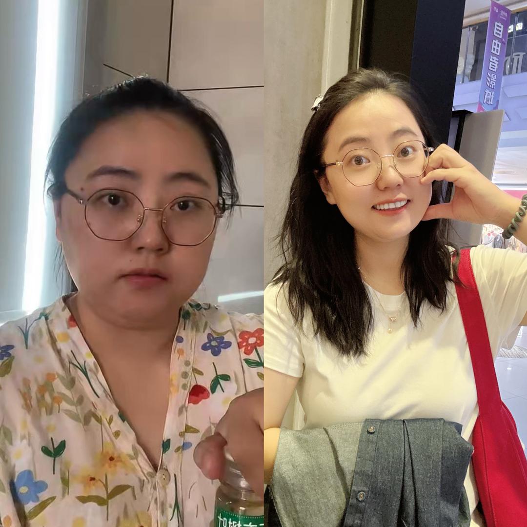 张小胖儿✨（已瘦30斤）